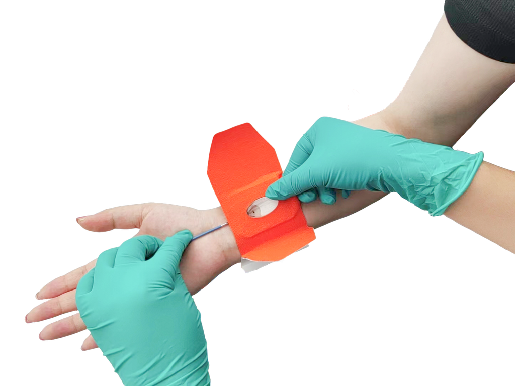 Arterial Hemostasis Compressor
